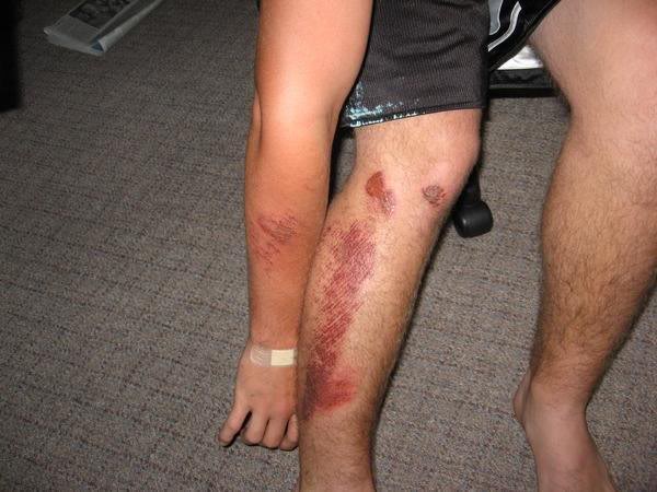 Name:  motorcyclewreck.jpg
Views: 25
Size:  48.0 KB