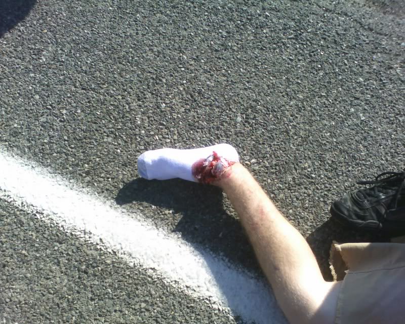 Name:  Justinsfoot.jpg
Views: 46
Size:  162.5 KB