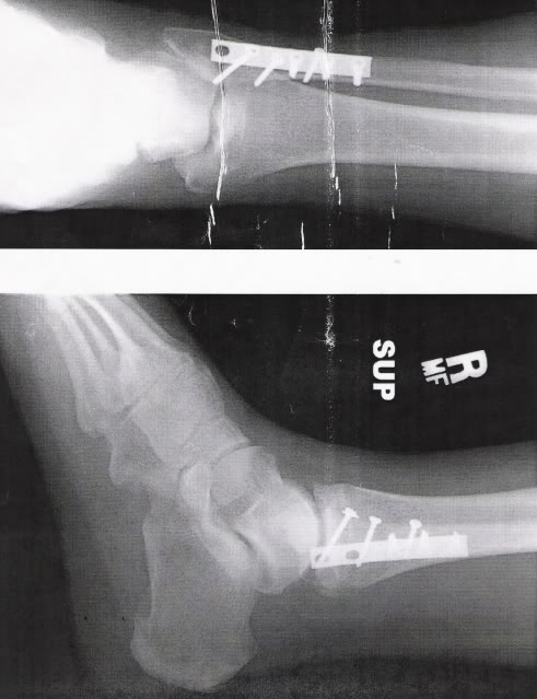 Name: legscrews.jpg
Views: 67
Size: 44.9 KB