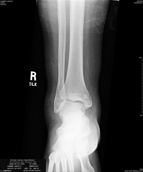 Name: xray3Medium.jpg
Views: 852
Size: 16.7 KB
