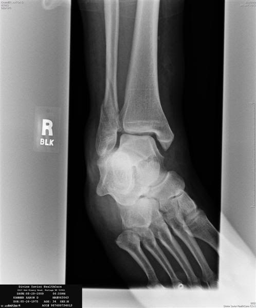 Name: xray2Medium.jpg
Views: 888
Size: 25.0 KB