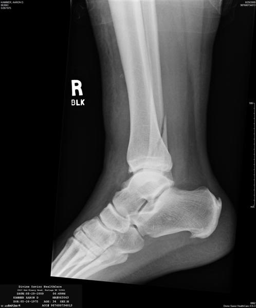 Name: xray1Medium.jpg
Views: 833
Size: 19.2 KB