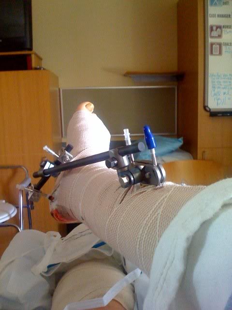 Name:  untitled.jpg
Views: 32
Size:  36.1 KB