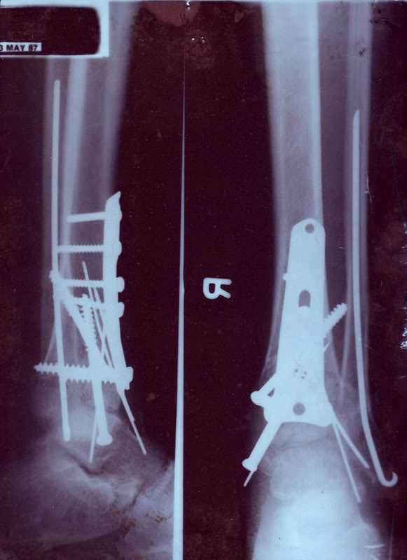 Name:  XRAY.jpg
Views: 20
Size:  60.5 KB