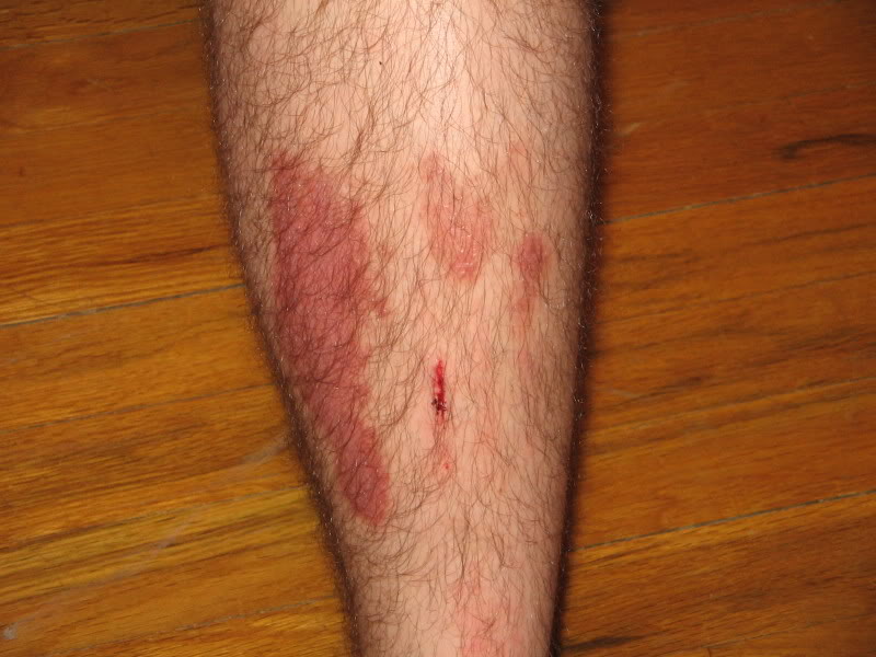 Name: leg002.jpg
Views: 26
Size: 78.0 KB