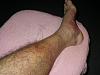 Toe guard-bruised-leg-2.jpg