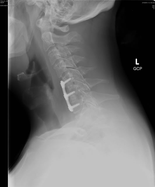 Name:  xray2.jpg
Views: 8
Size:  18.0 KB