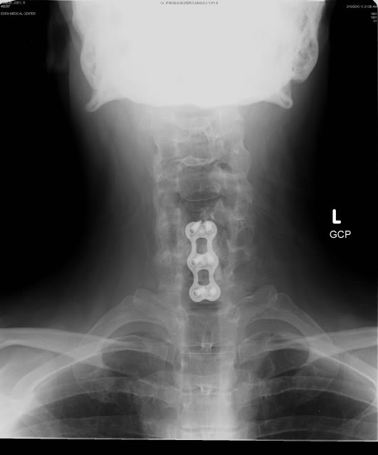 Name:  xray1.jpg
Views: 11
Size:  22.5 KB