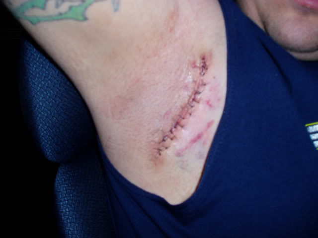 Name:  P4170010.jpg
Views: 17
Size:  28.2 KB