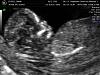 pictures of my baby-9-16-09_1.jpg