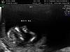 pictures of my baby-9-16-09_2.jpg