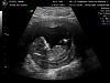pictures of my baby-9-16-09_3.jpg
