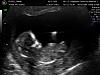 pictures of my baby-9-16-09_4.jpg