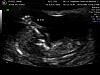 pictures of my baby-9-16-09_6.jpg