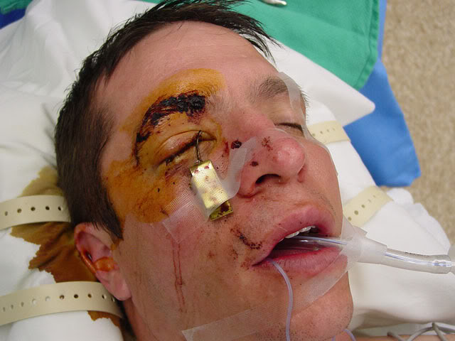 Name:  eyehook.jpg
Views: 12
Size:  53.5 KB