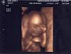 Its a....-ultrasound-4dsleeper.jpg
