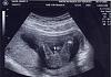Its a....-ultrasound-itsaboy.jpg