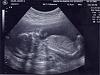 Its a....-ultrasound-bodyprofile.jpg